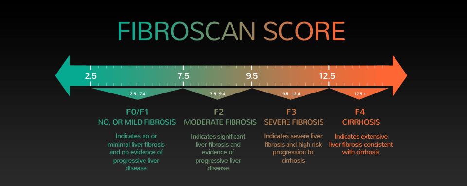 FibroScan Scale from F0 to F4